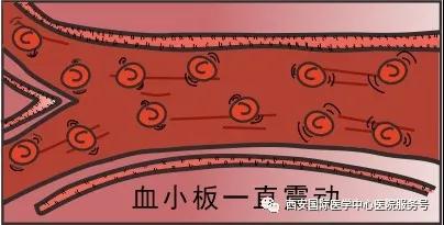 【科普】血小板是正常值的三倍？专家提醒小心血栓和出血！