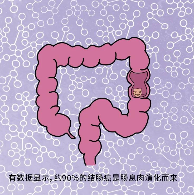 夺走“黑豹”生命的结肠癌，到底什么来头？